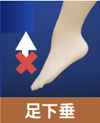 足下垂